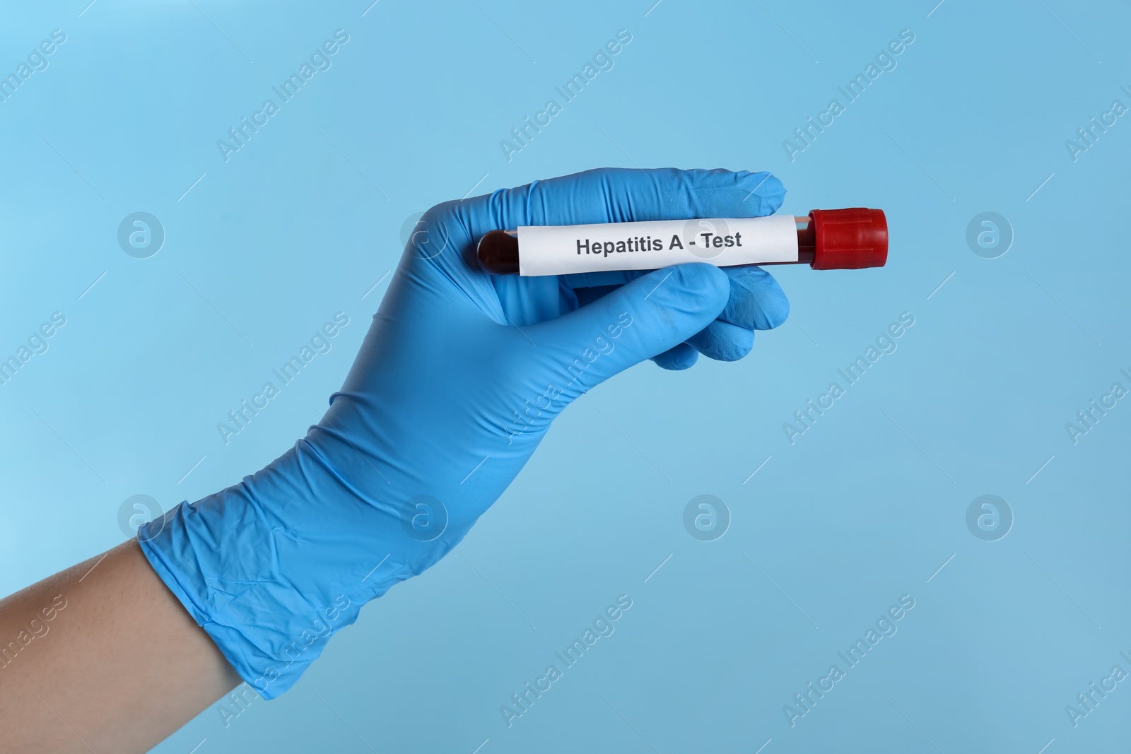 Photo of Scientist holding tube with blood sample and label Hepatitis A Test on light blue background, closeup