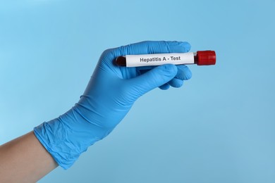 Scientist holding tube with blood sample and label Hepatitis A Test on light blue background, closeup