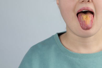 Photo of Gastrointestinal diseases. Woman showing her yellow tongue on light grey background, closeup. Space for text