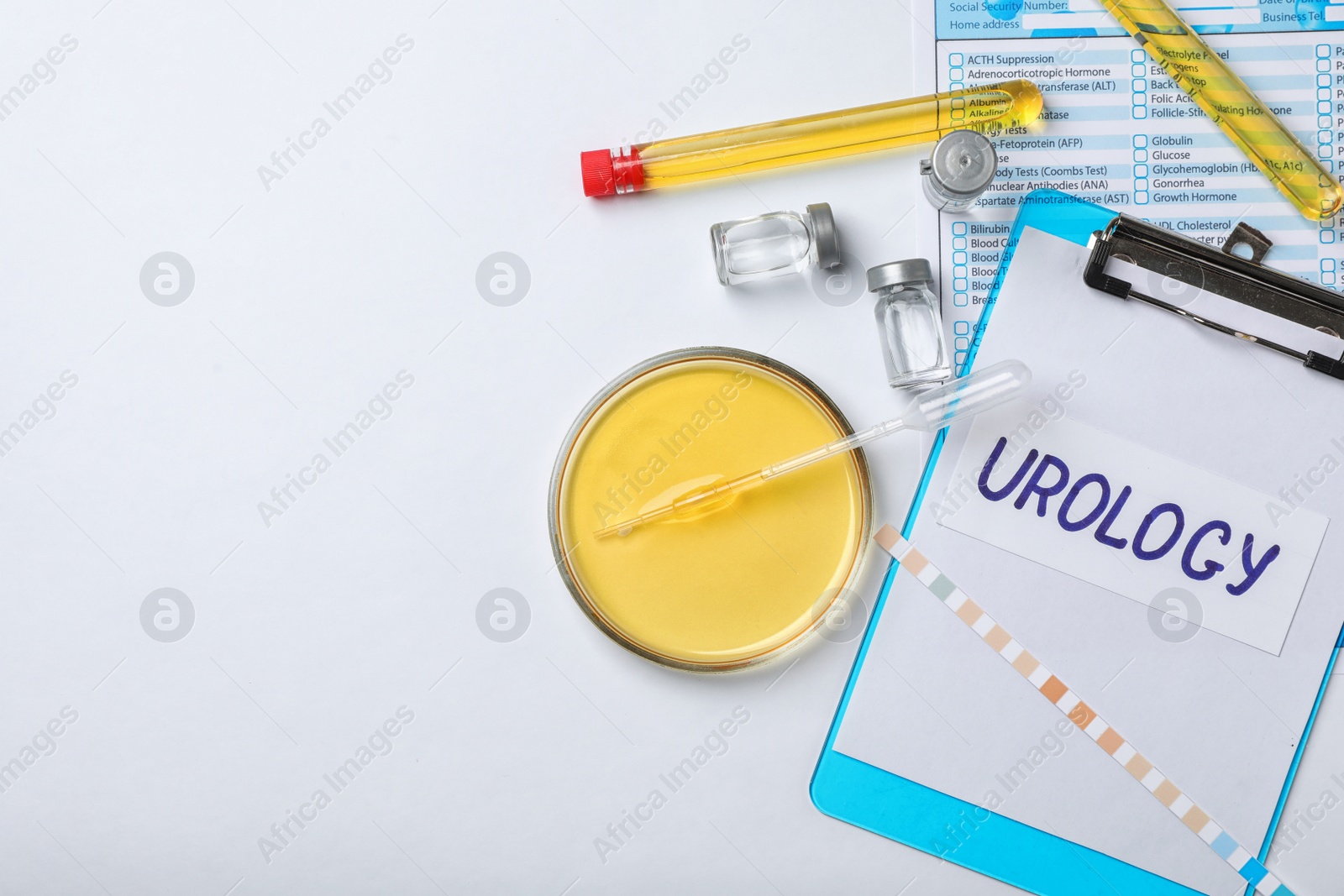 Photo of Flat lay composition with laboratory equipment and urine samples on light background. Urology concept