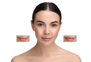Image of Attractive woman with beautiful lips on white background. Zoomed areas showing difference in lip fullness due to cosmetic procedure
