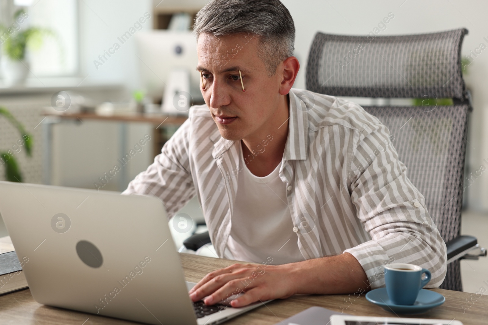 Photo of Sleepy man keeping eyes wide open with matches at workplace in office