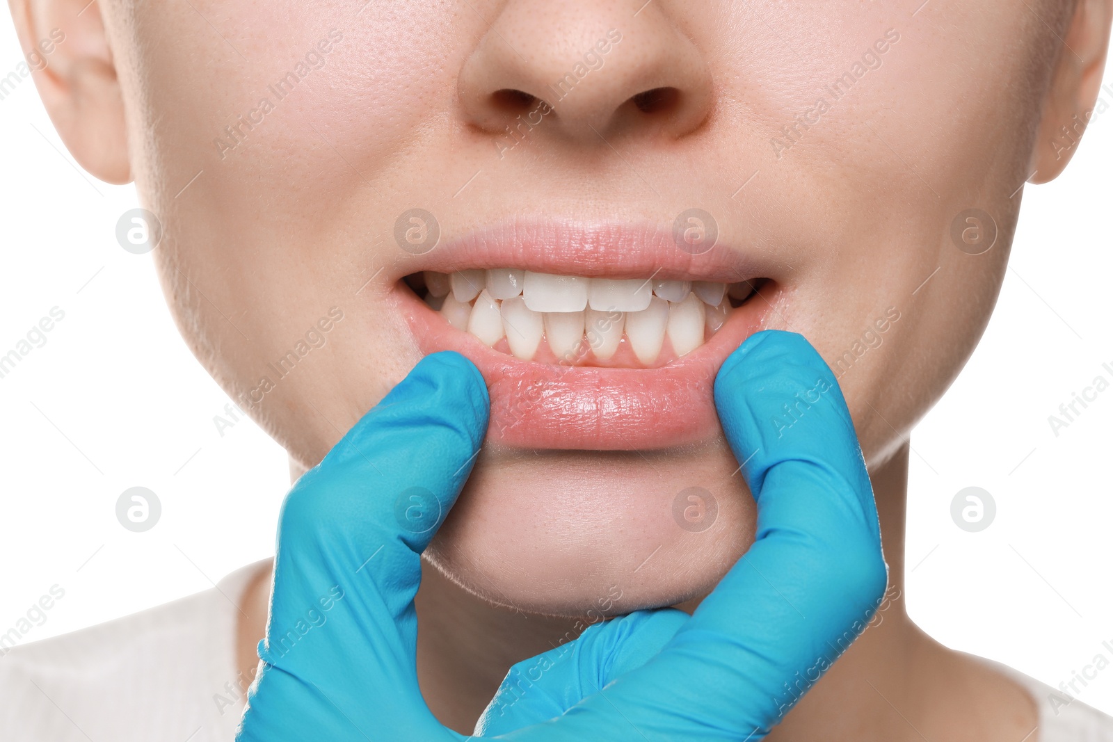 Photo of Doctor examining woman's gums on white background, closeup