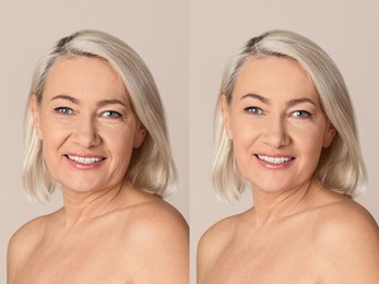 Image of Beautiful mature woman before and after cosmetic procedure on beige background, collage. Plastic surgery