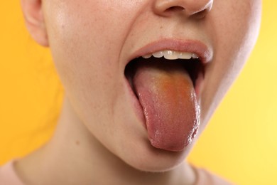 Photo of Gastrointestinal diseases. Woman showing her yellow tongue on color background, closeup