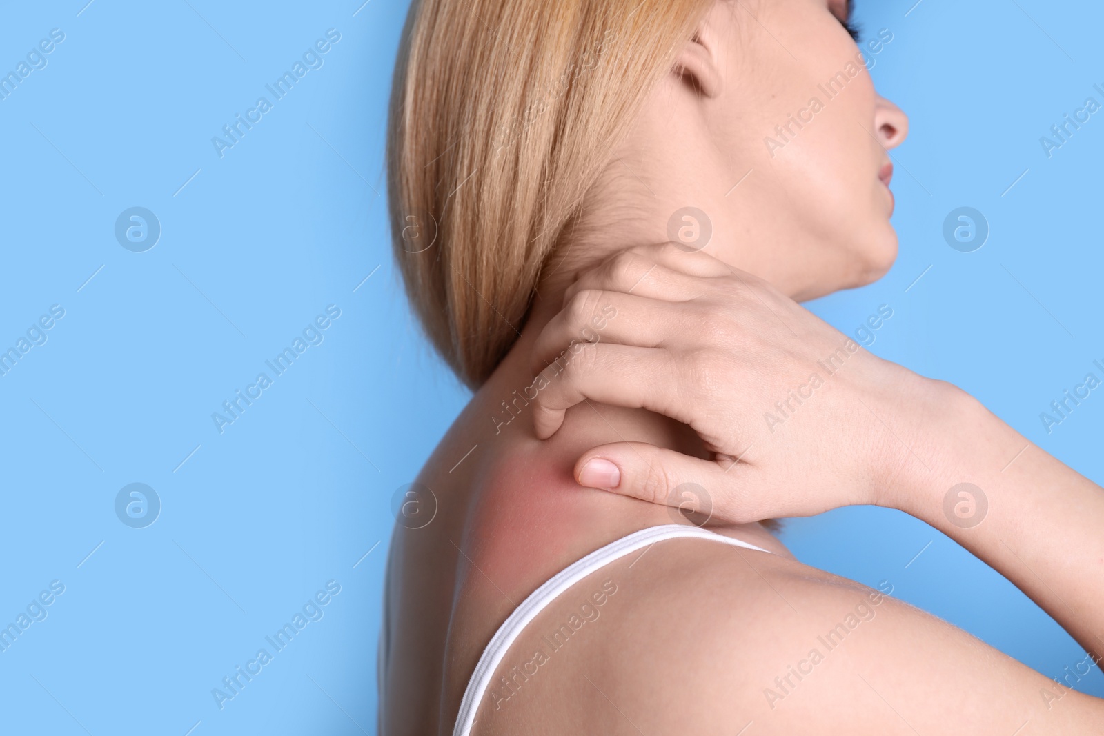 Photo of Woman with allergy symptoms scratching neck on color background, closeup. Space for text