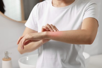 Photo of Suffering from allergy. Young woman scratching her arm in bathroom, closeup