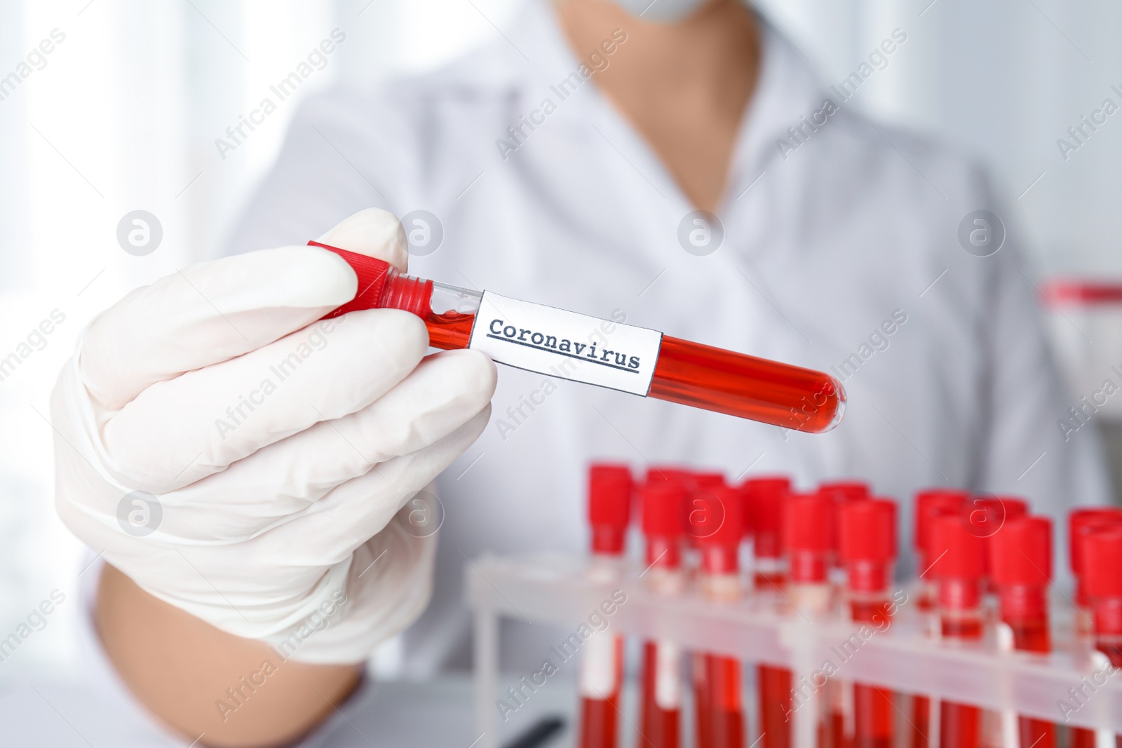 Photo of Scientist holding test tube with blood sample and label CORONA VIRUS in laboratory, closeup