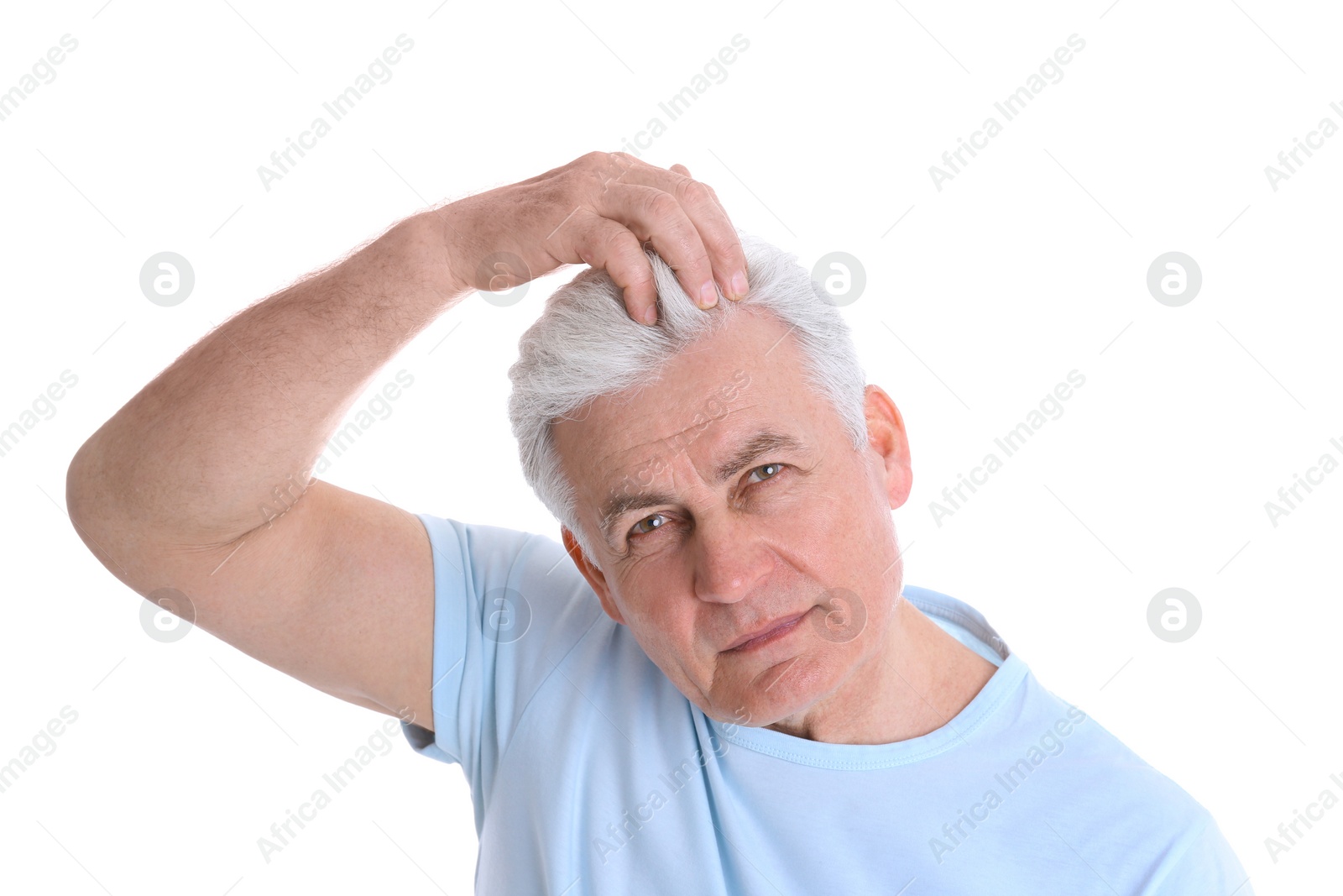 Photo of Senior man with hair loss problem isolated on white
