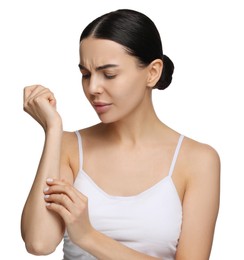 Photo of Young woman with dry skin on white background