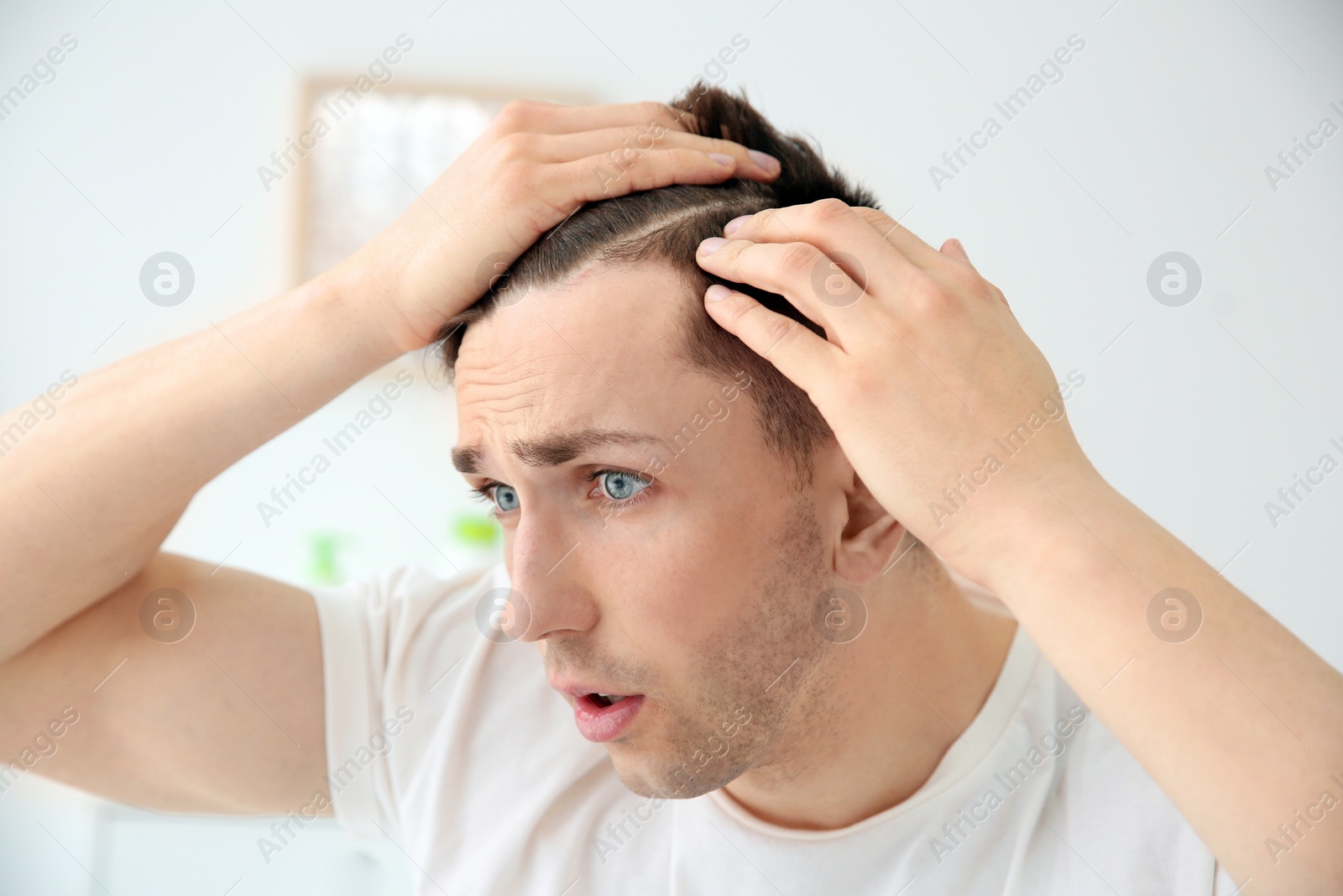 Photo of Young man with hair loss problem indoors