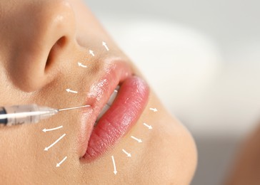 Image of Young woman getting lips injection on blurred background. Cosmetic surgery