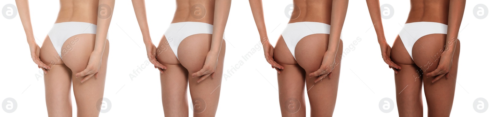 Image of Young woman with beautiful body on white background, closeup. Collage showing stages of suntanning, banner design