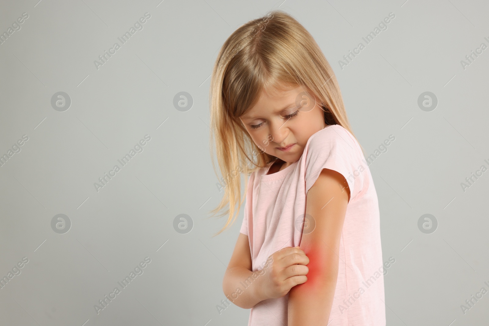 Photo of Suffering from allergy. Little girl scratching her arm on light gray background, space for text