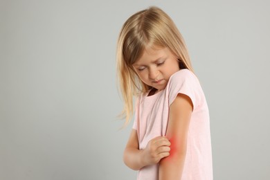 Photo of Suffering from allergy. Little girl scratching her arm on light gray background, space for text