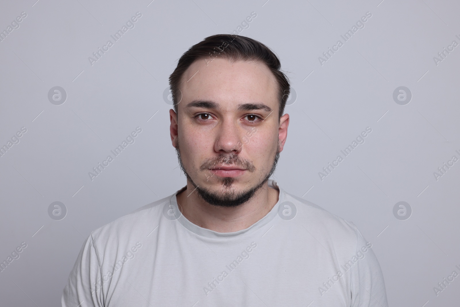 Photo of Baldness concept. Sad man with receding hairline on light grey background