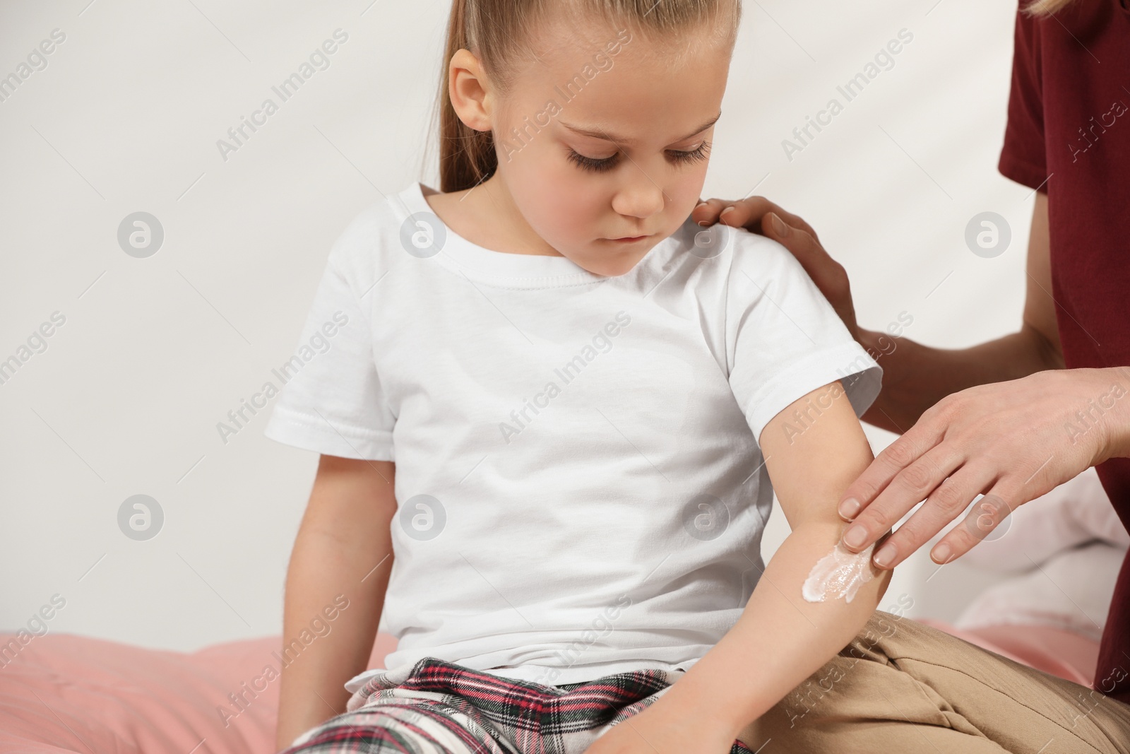 Photo of Mother applying ointment onto her daughter's arm on bed