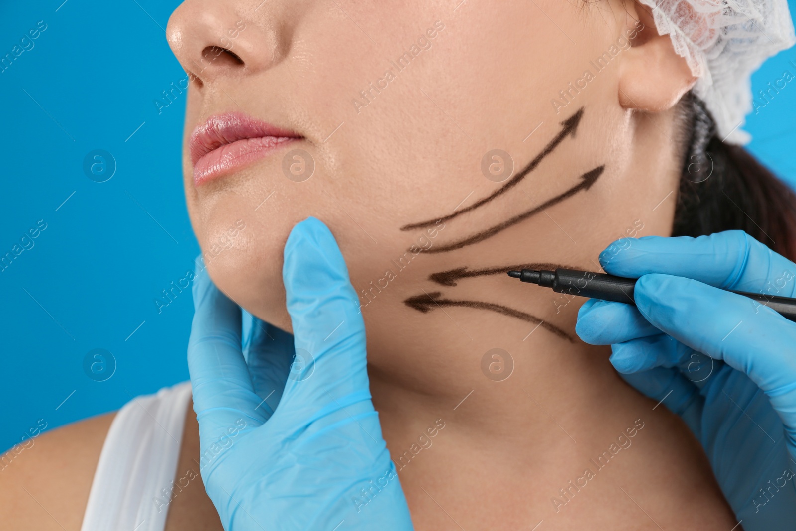 Photo of Doctor drawing marks on woman's face for cosmetic surgery operation against blue background, closeup. Double chin problem