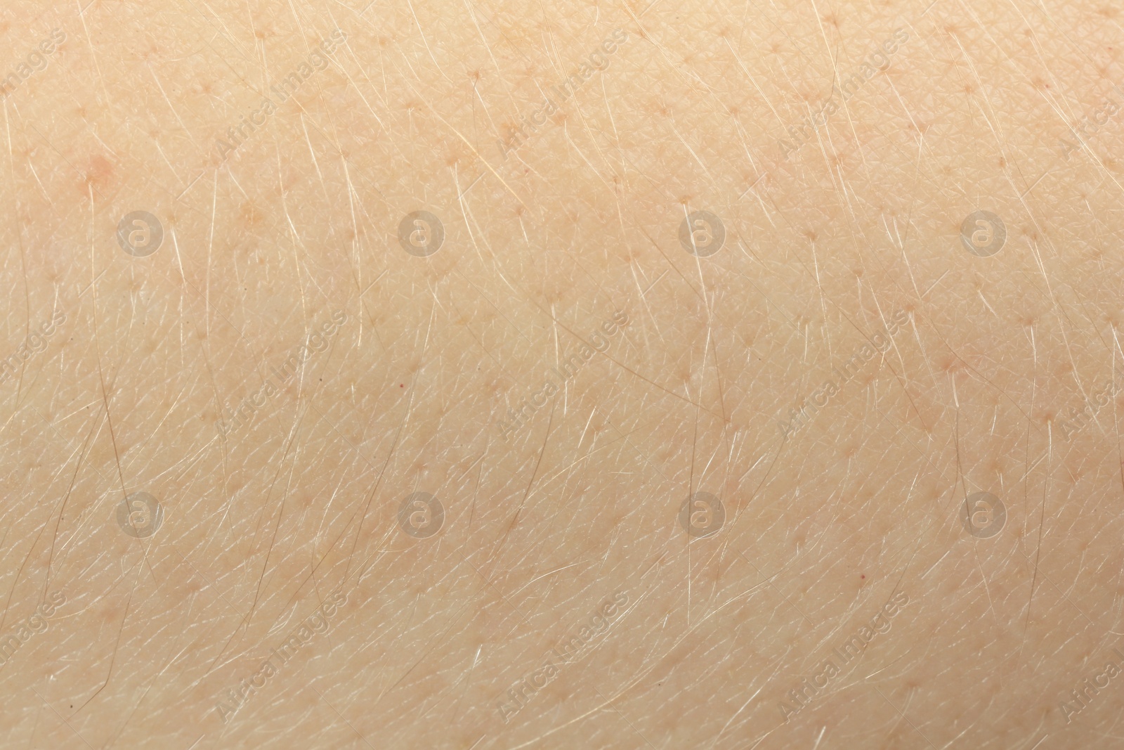 Photo of Texture of dry skin as background, macro view