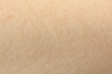 Photo of Texture of dry skin as background, macro view