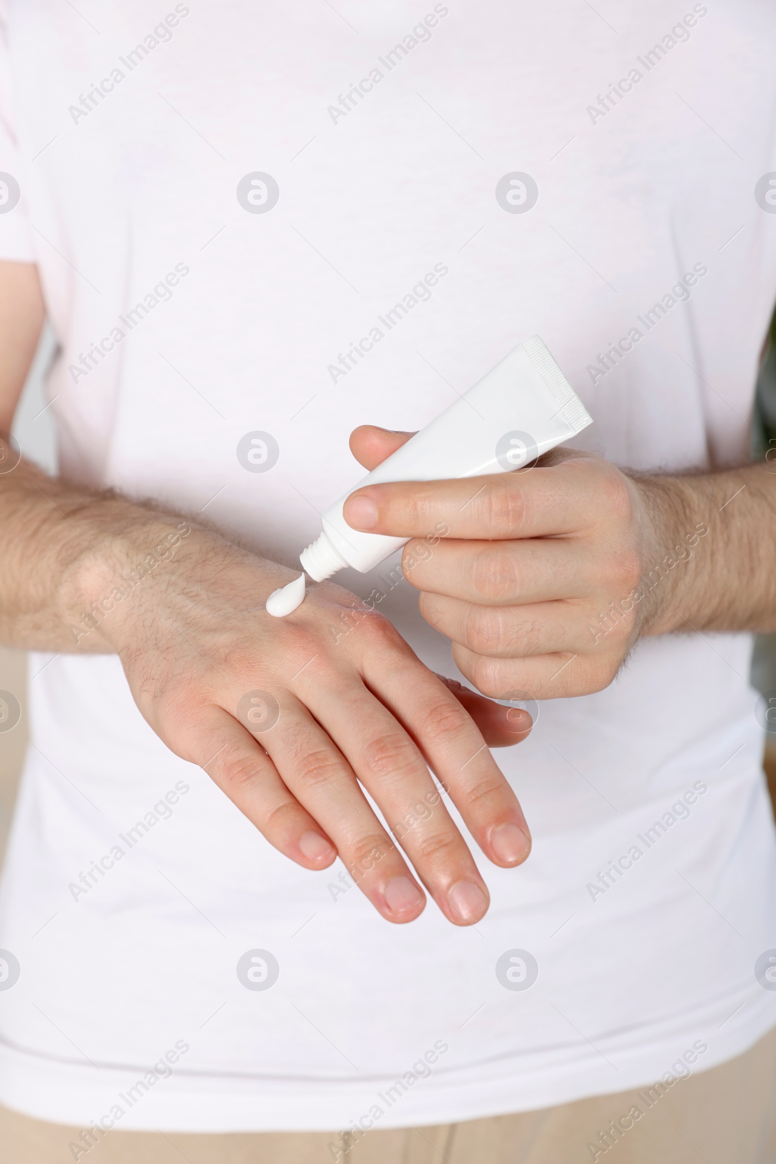 Photo of Man applying cream from tube onto hand, closeup