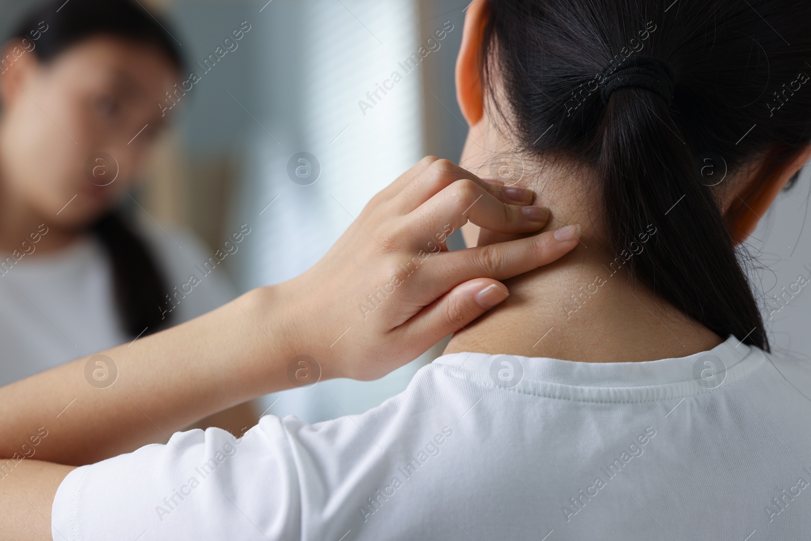 Photo of Suffering from allergy. Young woman scratching her neck near mirror indoors, back view