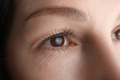 Photo of Closeup view of mature woman suffering from cataract