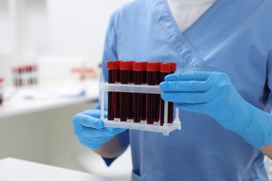 Photo of Laboratory testing. Doctor with blood samples in tubes at hospital, closeup