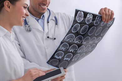 Doctors examining MRI images of patient with multiple sclerosis in clinic
