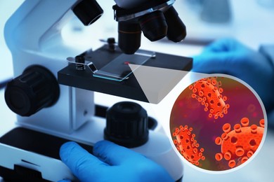 Scientist studying monkeypox virus under microscope at laboratory, closeup
