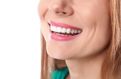 Smiling woman with perfect teeth on white background, closeup