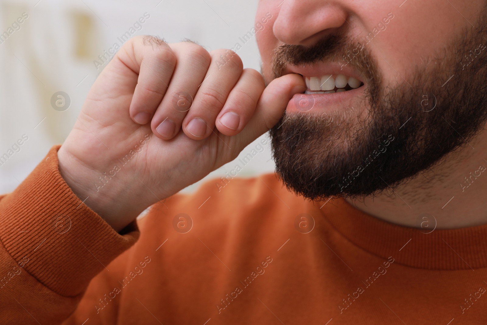 Photo of Man biting his nails on blurred background, closeup. Bad habit