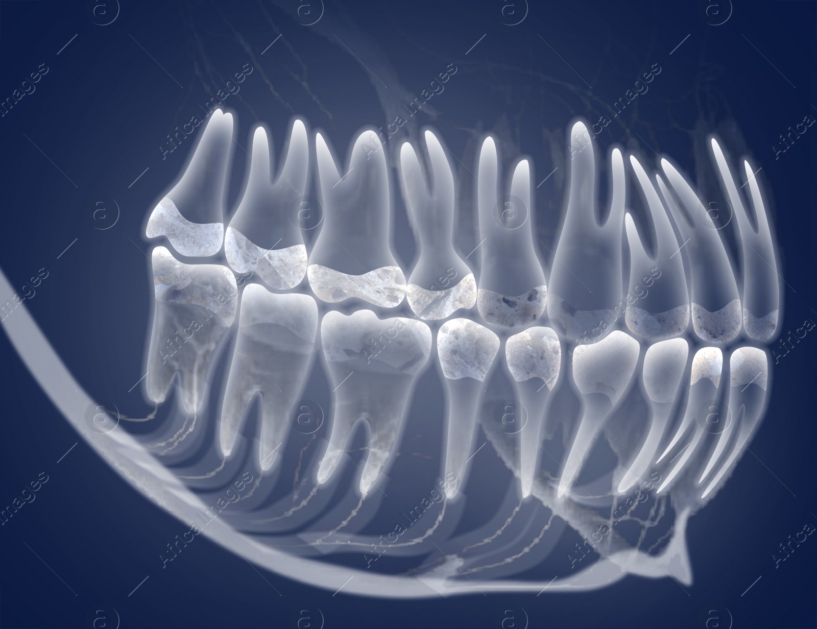 Illustration of X-ray picture of oral cavity with teeth