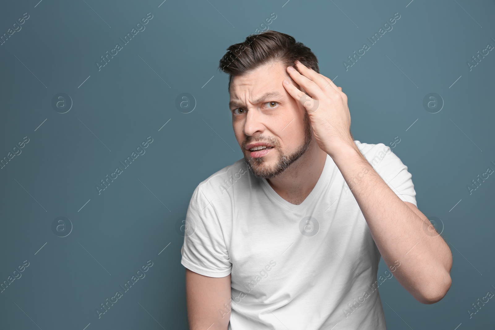 Photo of Young man with hair loss problem on color background