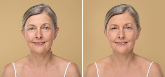 Image of Aging skin changes. Collage with photos of mature woman before and after cosmetic procedure on beige background
