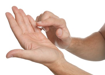 Man applying cream on hand for calluses treatment against white background, closeup