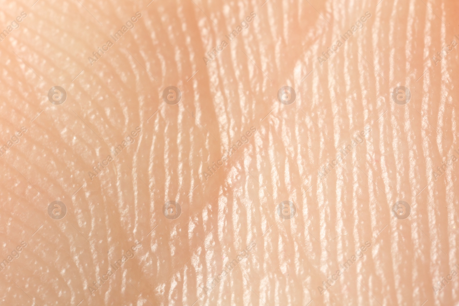 Photo of Texture of dry skin as background, macro view