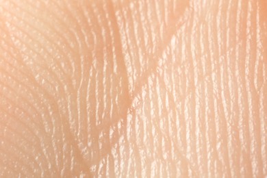 Photo of Texture of dry skin as background, macro view