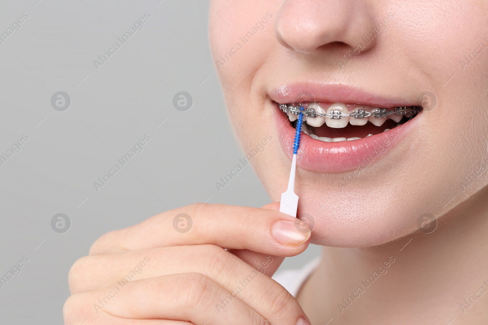 Photo of Smiling woman with dental braces cleaning teeth using interdental brush on grey background, closeup. Space for text