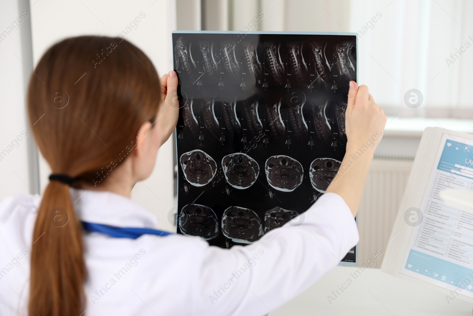 Photo of Professional orthopedist examining X-ray picture in her office