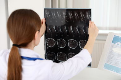 Photo of Professional orthopedist examining X-ray picture in her office