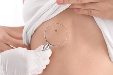 Dermatologist examining patient with magnifying glass in clinic, closeup view