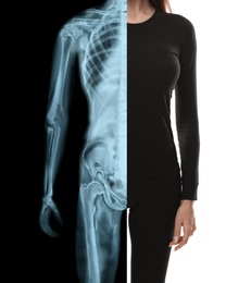Image of Woman in black clothes, half x-ray photograph. Medical check