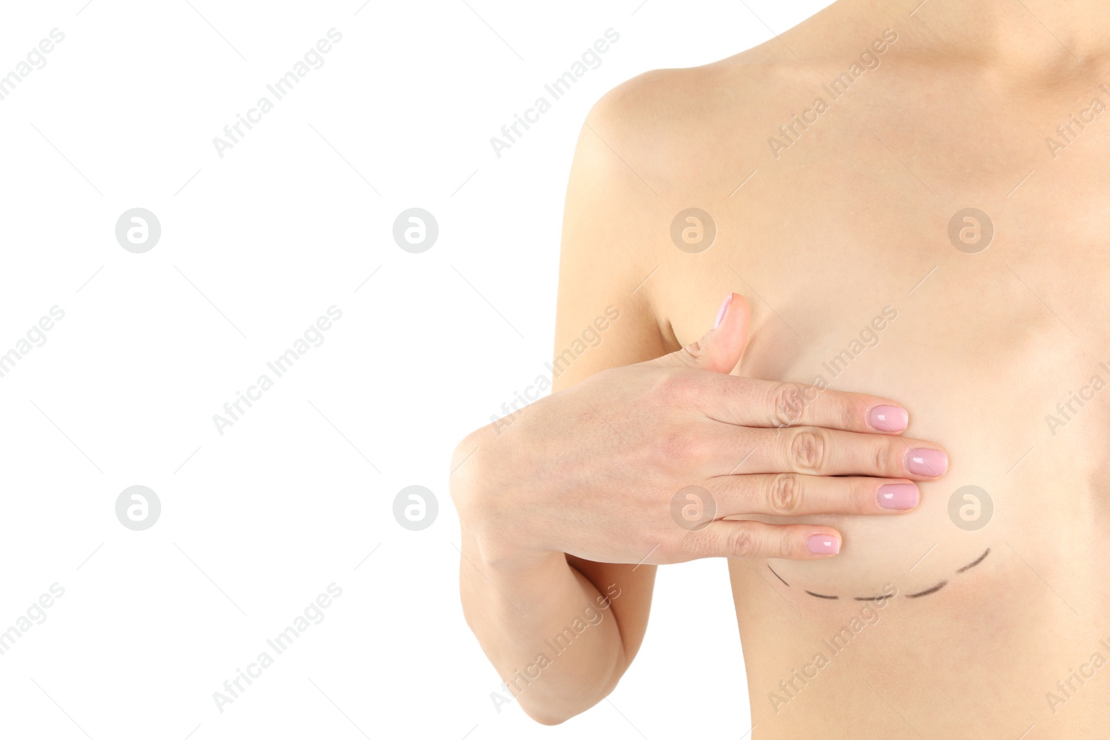 Photo of Young woman with marks on breast for cosmetic surgery operation against white background, closeup