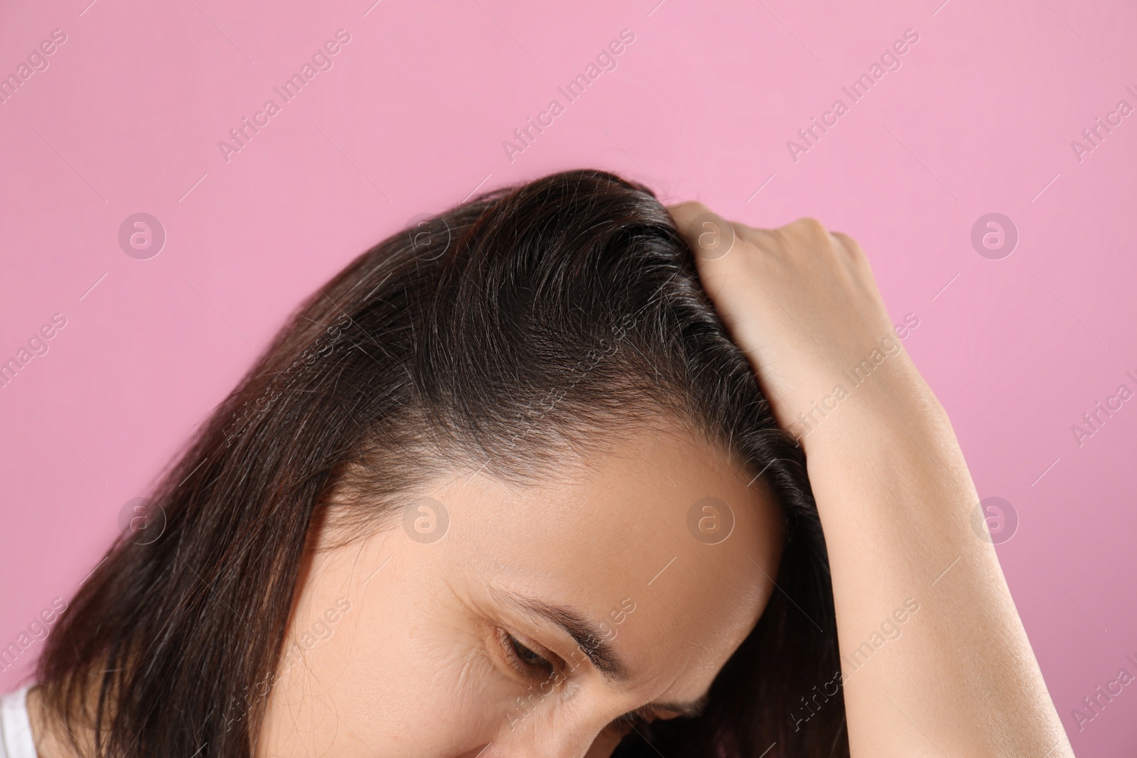 Photo of Mature woman suffering from baldness on pink background, closeup