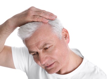 Senior man with hair loss problem isolated on white