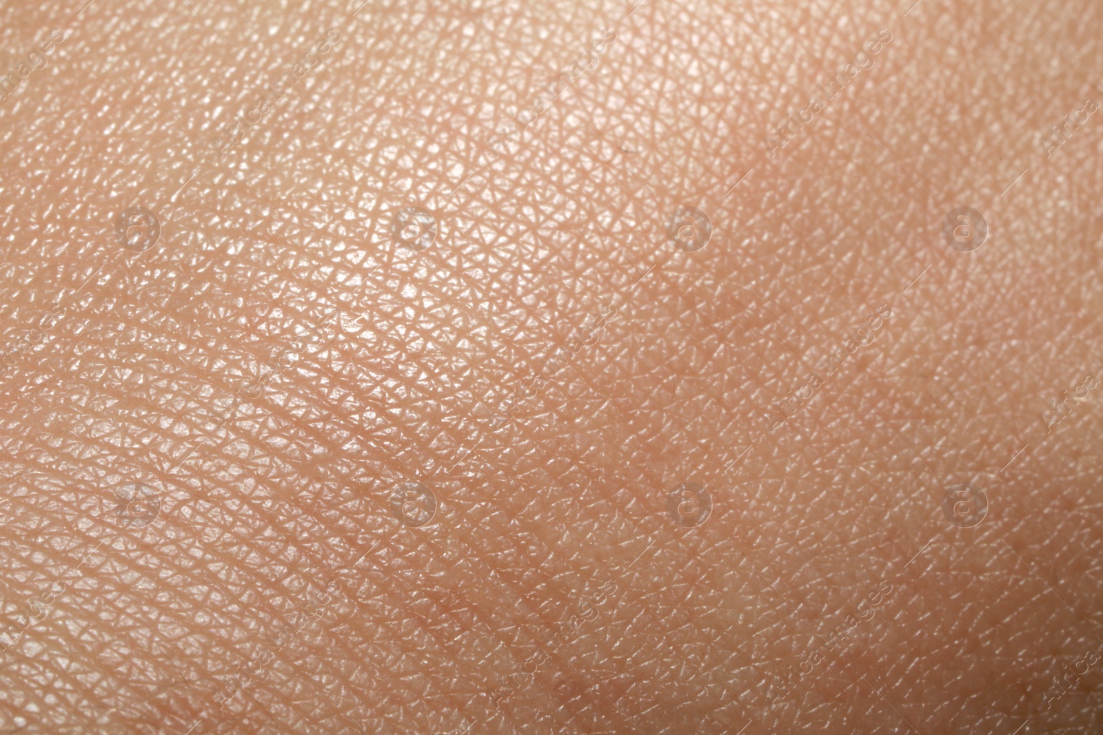 Photo of Closeup view of dry human skin as background