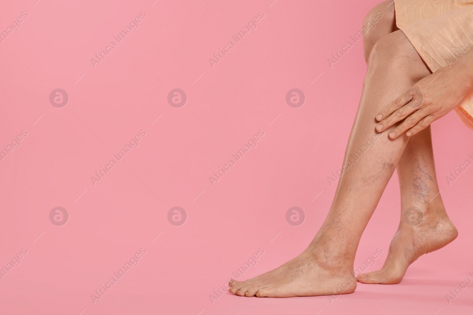 Photo of Closeup view of woman suffering from varicose veins on pink background. Space for text