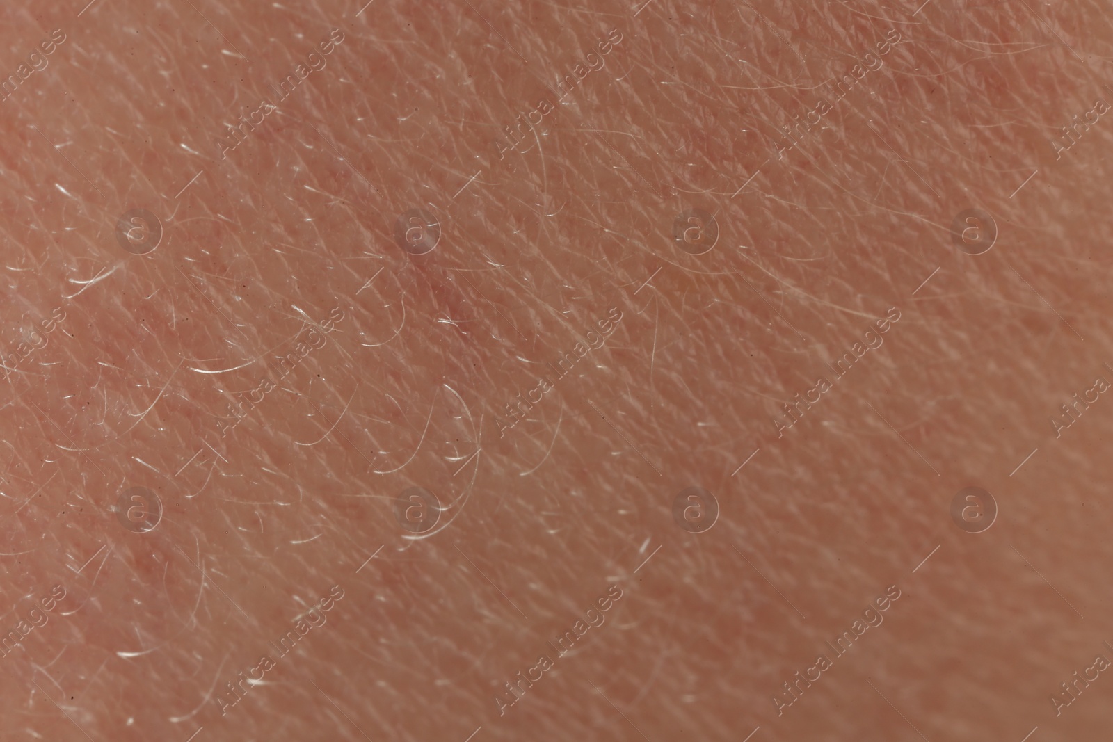 Photo of Texture of dry skin as background, macro view