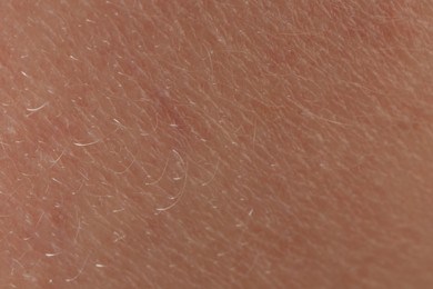 Texture of dry skin as background, macro view